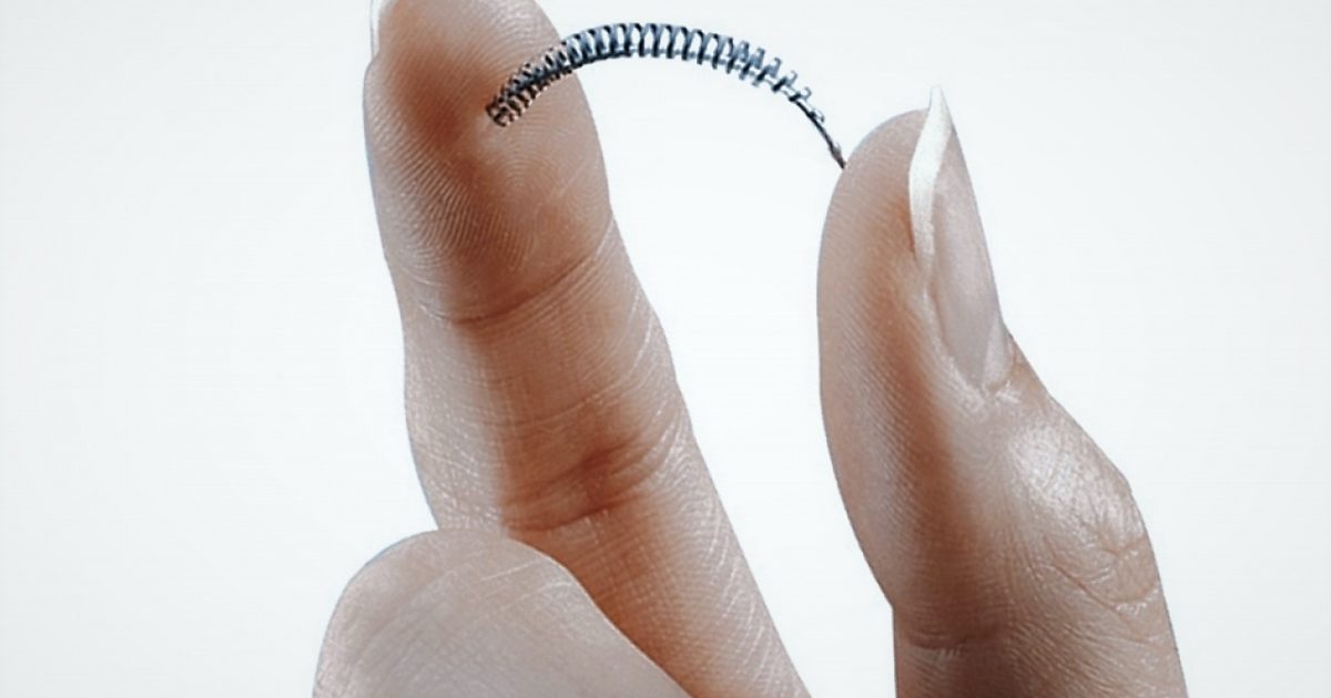 Essure, contraccettivo Bayer, ha danneggiato più di 35.000 donne che saranno risarcite